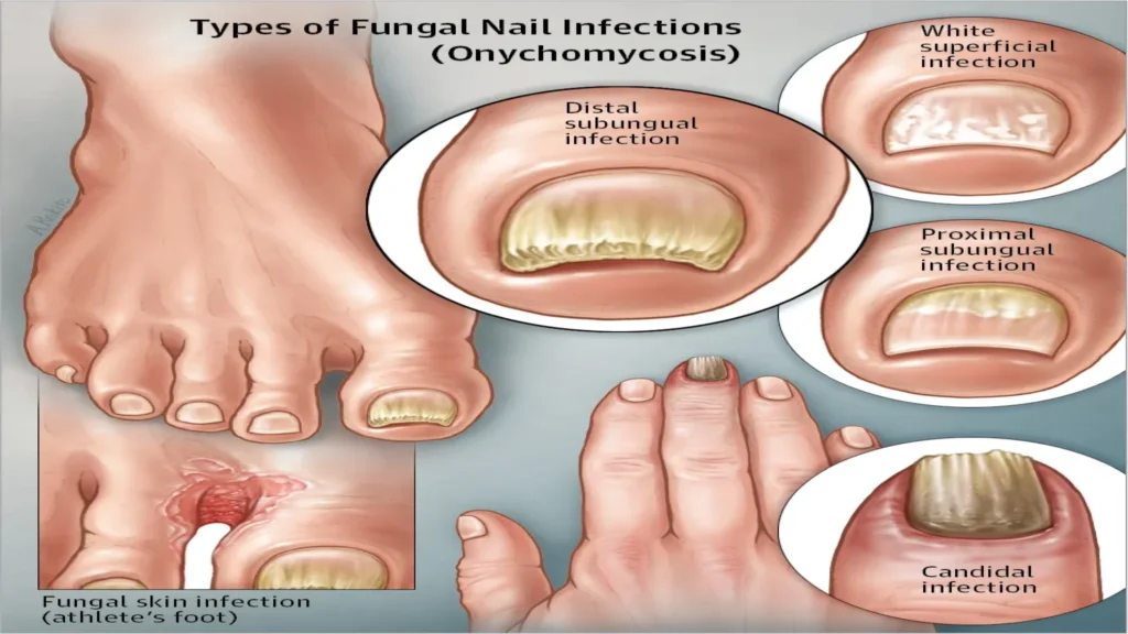 Foot trooper - México - foro - comentarios - donde comprar - ingredientes - qué es esto - opiniones - precio - en farmacias