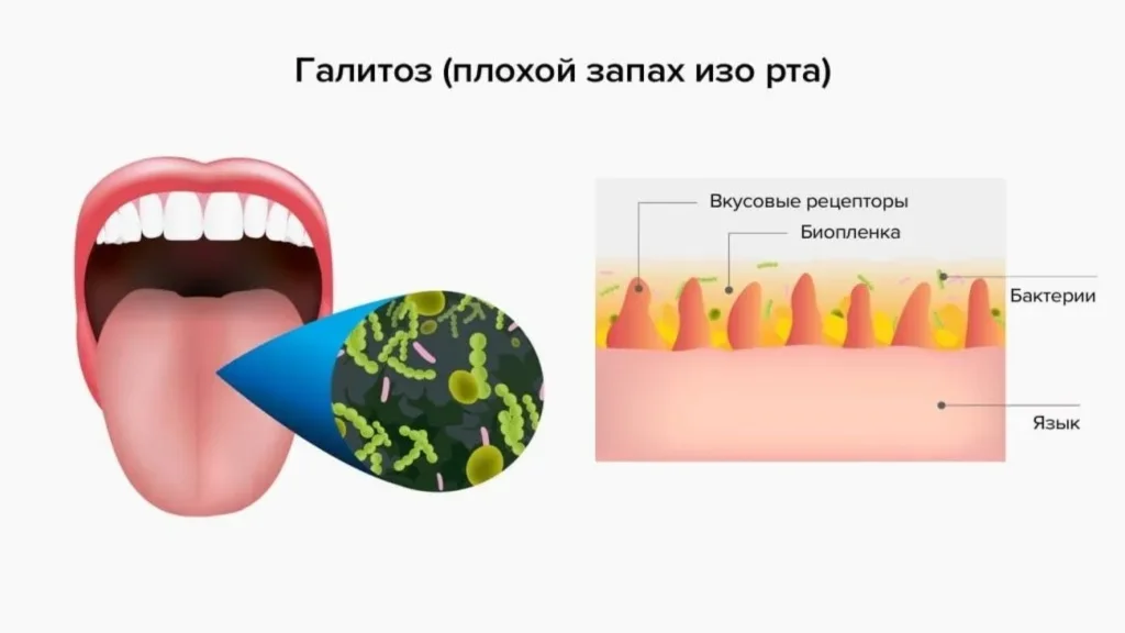 Vormixil - opinioni - prezzo - sito ufficiale - recensioni - in farmacia - Italia - composizione