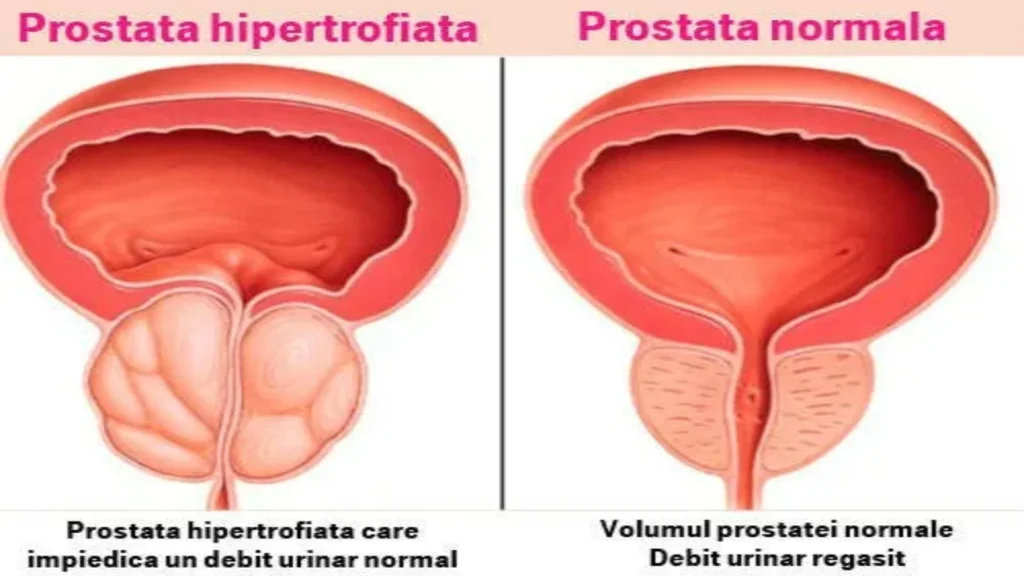 Deluron forte - sito ufficiale - composizione - prezzo - Italia - opinioni - recensioni - in farmacia